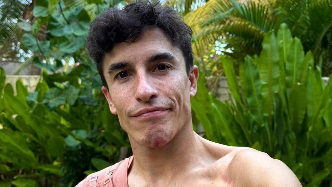 Marc Marquez Dipastikan Absen di Dua Seri MotoGP, Harus Istirahat Total